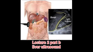 Abdominal ultrasound course  lecture 2 part b  liver د عمرو صلاح [upl. by Schrader]