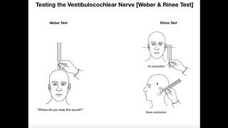 Interpreting the WeberRinne Tests EXPLAINED [upl. by Avram]