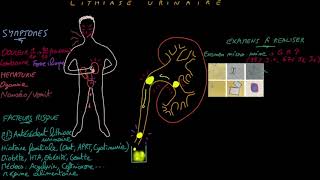 Lithiase urinaire  Docteur Synapse [upl. by Eelyma]