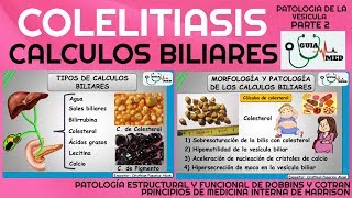 CÁLCULOS BILIARES FISIOPATOLOGÍA PARTE 2  GuiaMed [upl. by Imoin]