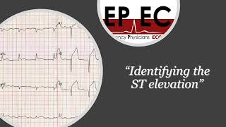 ECG Tip 1 Where is the isoelectric line [upl. by Eaver]