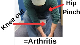 Classic Sign of Hip ArthritisThis is the SIMPLEST test to identify it [upl. by Zingg657]