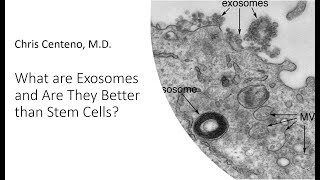 What are Exosomes Are They Better than Stem Cells [upl. by Wesa752]