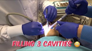 FILLING 3 CAVITIES [upl. by Leanor210]