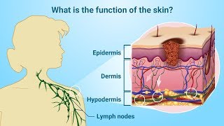 Understanding Melanoma [upl. by Antonetta]