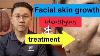 Growths on YOUR Face  Identifying and Treatment Part 12 [upl. by Triny]