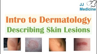 Introduction to Dermatology  The Basics  Describing Skin Lesions Primary amp Secondary Morphology [upl. by Nicol]