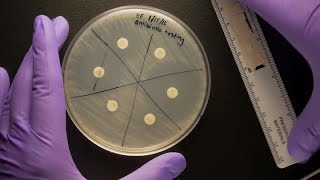 ID Laboratory Videos Antibiotic susceptibility testing [upl. by Andrej]