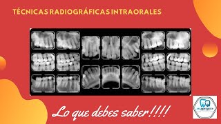 Técnicas Radiográficas Intraorales Periapical o Retroalveolar  Bite wing  oclusal [upl. by Nilorac483]