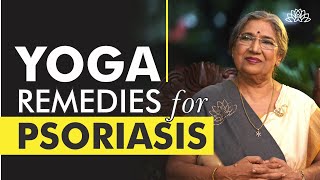 Best Home Remedies for Psoriasis  Dr Hansaji Yogendra [upl. by Nidla241]