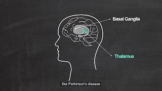 Thalamic Mechanism of Parkinson Disease [upl. by Lihcox550]