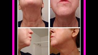 Fascia Blaster Does it work Face blastingfasceblaster fasciablaster wrinkles matureskin [upl. by Lienet]