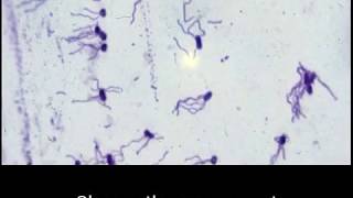 Structural stains Endospore capsule and flagella [upl. by Maiocco]