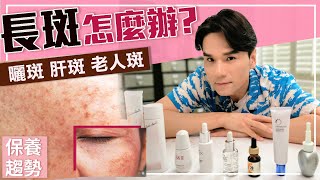 超強淡斑攻略，雀斑、曬斑、孕斑、老人斑一次搞懂！ll Kevin想得美 ll How To Remove Dark Spots On Face [upl. by Carly473]