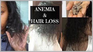 Anemia amp Hair Loss My Story and Recovery [upl. by Isabelita]