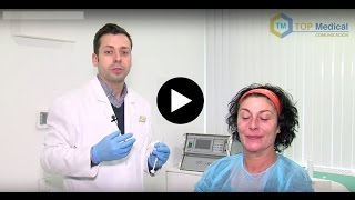 Tratamiento de Hidroxiapatita cálcica Murcia Rejuvenecimiento facial [upl. by Kazim911]