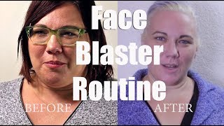 My FaceFascia Blaster Routine using Ashley Blacks Face Blaster [upl. by Rugg966]