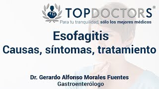 Esofagitis Causas síntomas y tratamiento [upl. by Alexandros]