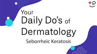 Seborrheic Keratosis  Daily Dos of Dermatology [upl. by Ellinnet]