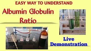 Albumin globulin ratio  Total protein estimation  Biuret method  Albumin estimation  BCG method [upl. by Runkle673]