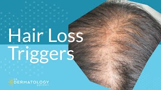 Common Hair Loss Triggers [upl. by Darryl]