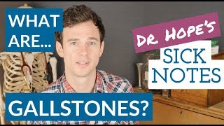 What are gallbladder stones [upl. by Darill947]