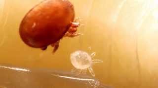 Biologie der Varroamilbe  Biology of the Varroa Mite [upl. by Yditsahc787]