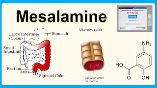 mesalamine [upl. by Crosby]