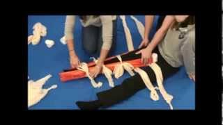 Splinting Lower Leg Fracture [upl. by Gascony]