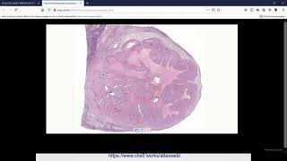 SVT 2nde  structure histologique de lovaire [upl. by Einnus293]